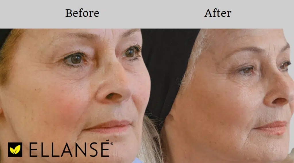 دکتر مهرداد تیموریان - متخصص پوست مو زیبایی و لیزر در گرگان متخصص پوست و مو و زیبایی در گرگان